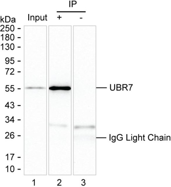 Anti-UBR7