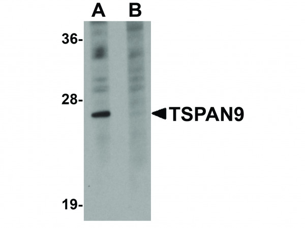 Anti-TSPAN9