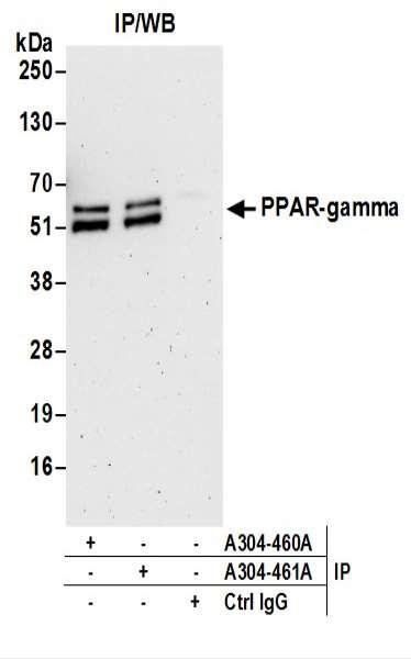 Anti-PPAR-gamma