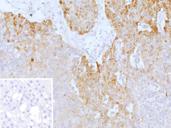 Anti-PRPH / Peripherin, clone rPJM50