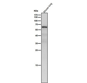 Anti-NR2C2 / Nuclear receptor subfamily 2 group C member 2 / TR4, clone 31N37