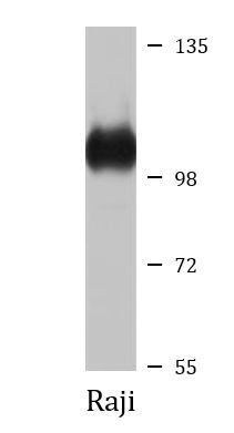Anti-Desmocollin 1