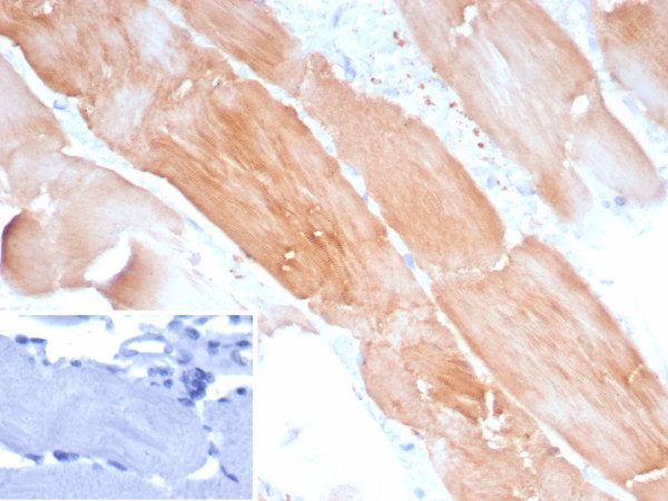 Anti-Sarcomeric Actinin Alpha 2 / ACTN2, recombinant antibody, clone ACTN2/8184R