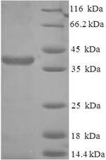 Protein SCO2 homolog, mitochondrial (SCO2), human, recombinant