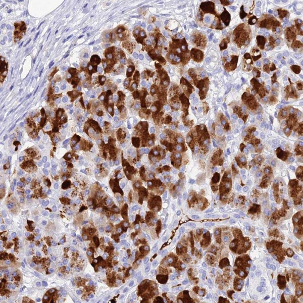 Anti-CELA3A