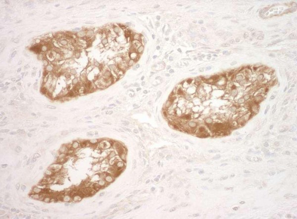 Anti-Vinculin (IHC)