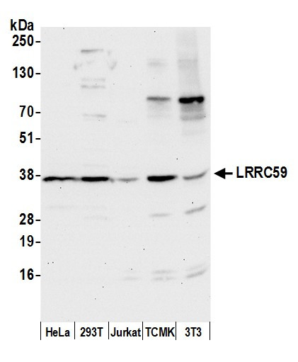 Anti-LRRC59