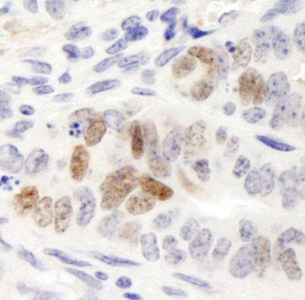 Anti-Nanog (IHC)