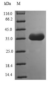 Tomoregulin-1 (TMEFF1), partial, human, recombinant