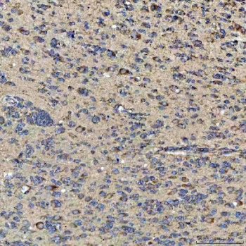 Anti-GlnRS / Glutaminyl-tRNA synthetase / QARS1