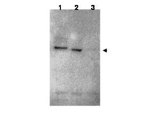 Anti-Ring finger protein 25 (RNF25)