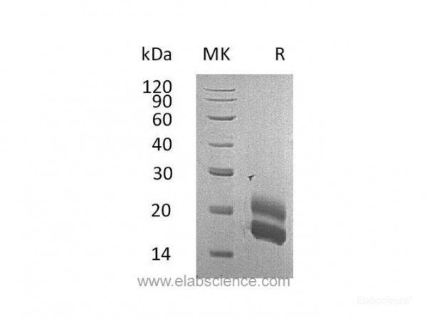 Granulocyte-Macrophage Colony-Stimulating Factor/GM-CSF Protein(C-6His) (recombinant rat)