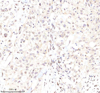 Anti-Lamin B2 / LMNB2