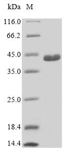 Uncharacterized protein C21orf2 (C21orf2), human, recombinant