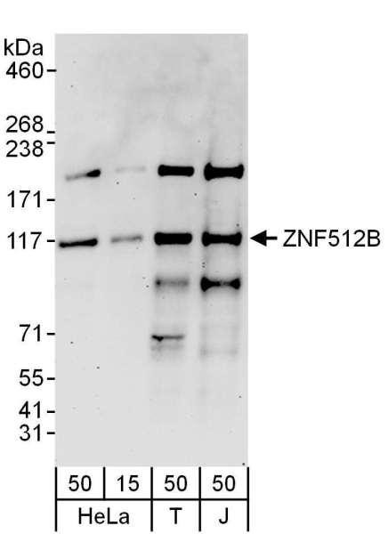 Anti-ZNF512B