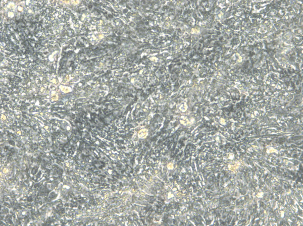 HROC59 T1 M1 Cells