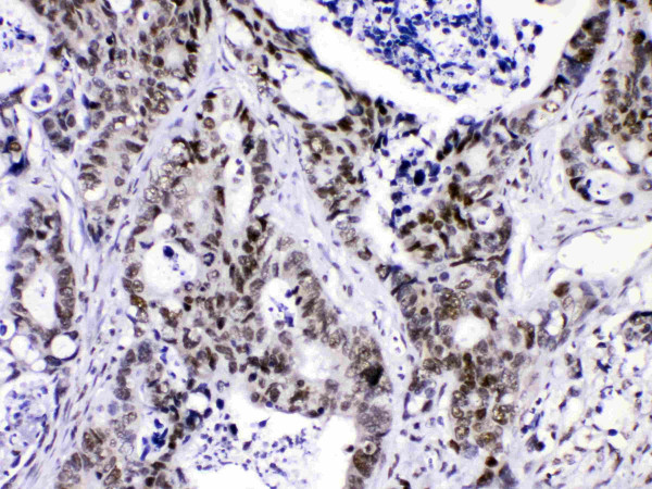Anti-hnRNP F