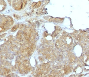 Anti-MVP / Major Vault Protein, clone MJVP-1R