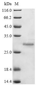 Replicase polyprotein 1ab (rep), partial, Avian infectious bronchitis virus, recombinant