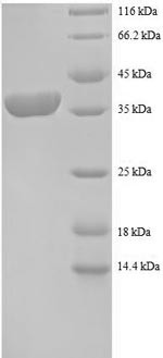 40S ribosomal protein S12 (RPS12), human, recombinant
