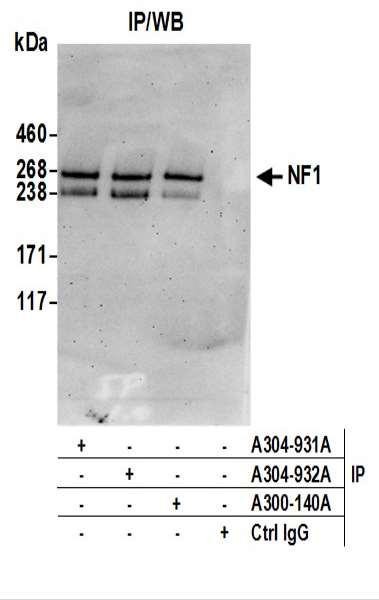 Anti-NF1
