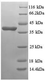 Annexin A3 (ANXA3), partial, human, recombinant