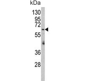 Anti-Arginyl-tRNA synthetase (mitochondrial) / RARS2