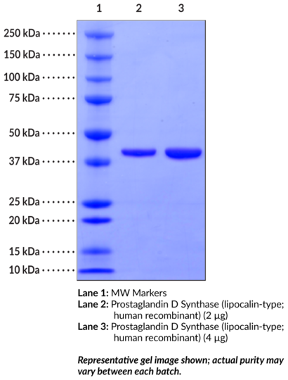 Prostaglandin D Synthase (lipocalin-type, human recombinant)
