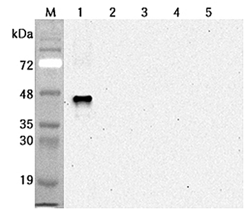 Anti-Sirtuin 6 (human), clone S6R82-2