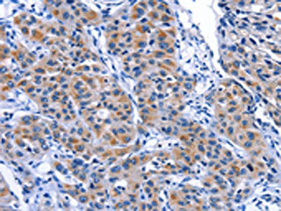 Anti-MYH1