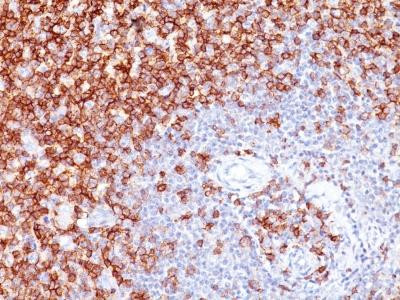 Anti-CD45RO (T-Cell Marker)(Clone: UCHL-1)