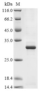 Metalloproteinase inhibitor 3 (Timp3), mouse, recombinant