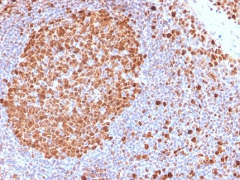 Anti-MCM7 (recombinant antibody), clone MCM7/2832R
