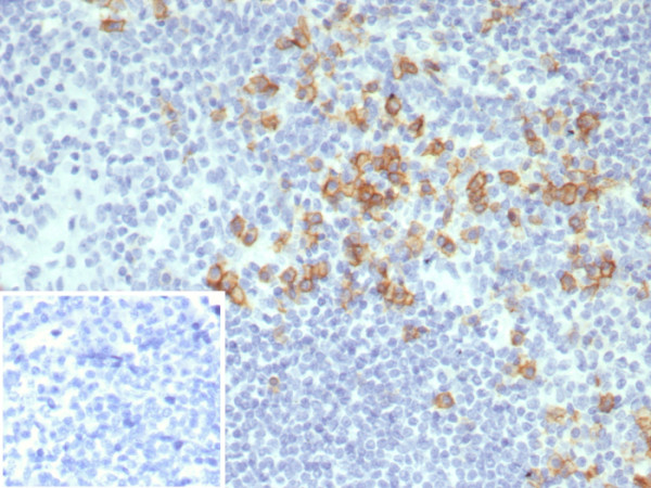 Anti-CD38 (ADP Ribosyl Cyclase I), recombinant antibody, clone CD38/8075R