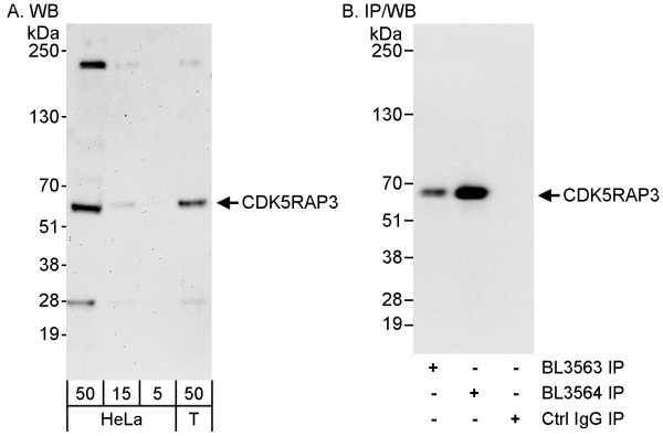 Anti-CDK5RAP3