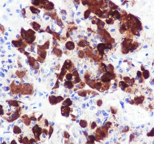 Anti-Recombinant ACTH, clone A681