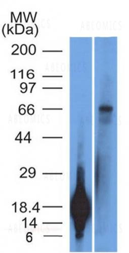 Anti-TRIM29 (Lung Squamous Cell Carcinoma Marker)(Clone: TRIM29/1042)