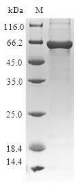 RISC-loading complex subunit TARBP2 (TARBP2), human, recombinant