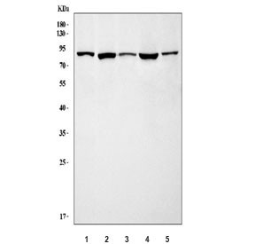 Anti-GRK3 / ADRBK2