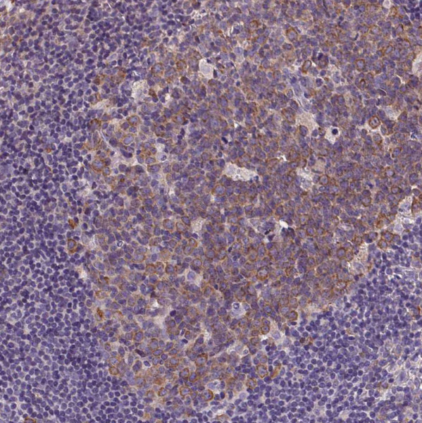 Anti-DTX1