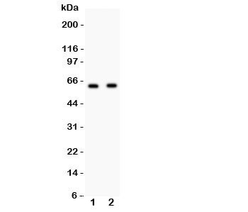 Anti-HEXB