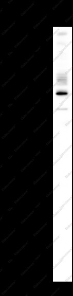 Anti-Recombinant IRE1alpha (Phospho Ser724), clone C111809