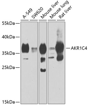 Anti-AKR1C4