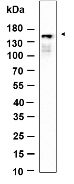 Anti-Recombinant Phospho-PLCgamma1 (Tyr783), clone 11A1