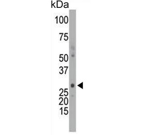 Anti-DCK / Deoxycytidine kinase