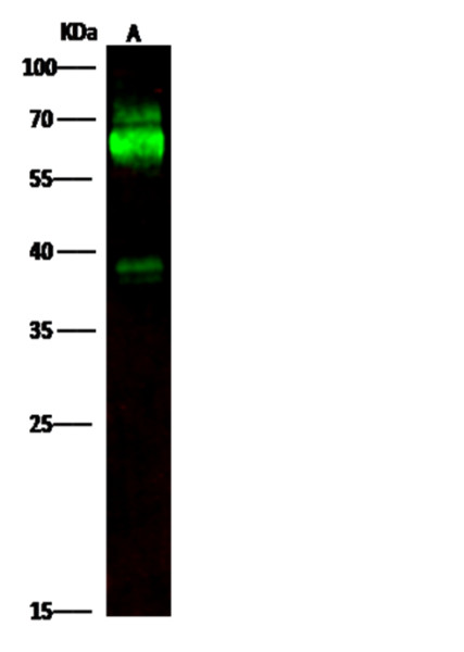 Anti-TH/Tyrosine Hydroxylase Monoclonal Recombinant Antibody