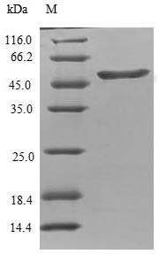 Tubulin polymerization-promoting protein (TPPP), human, recombinant