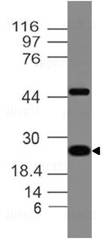 Anti-Adiponectin (Clone: ABM52A3 )