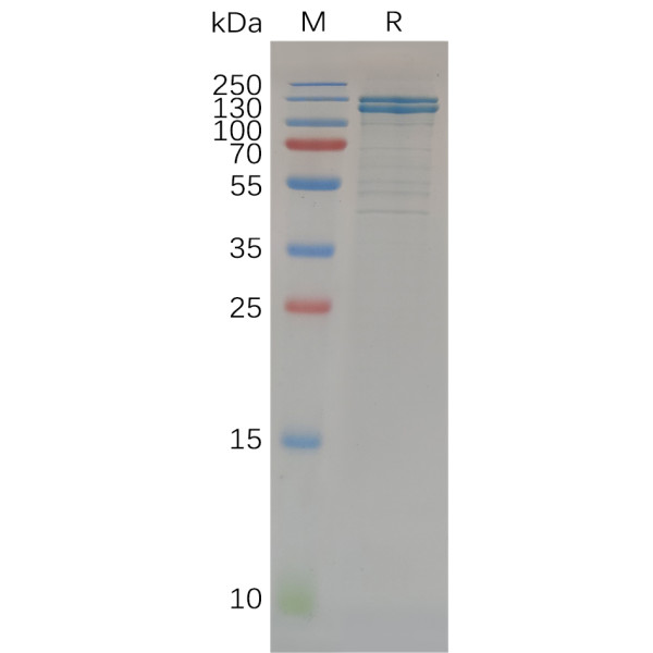 Human CDH1 Protein, hFc Tag
