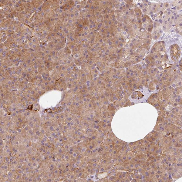 Anti-IQGAP2